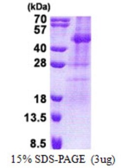 Novus Biologicals&trade;&nbsp;Recombinant Human TSSK2 His Protein