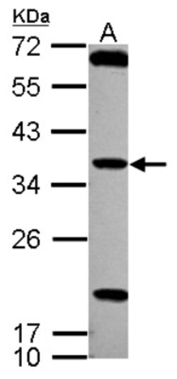 TSSK4 Antibody, Novus Biologicals 0.1 mL | Buy Online | Novus Biologicals | Fisher Scientific