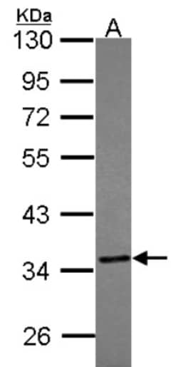 TST Antibody, Novus Biologicals 0.1mL; Unlabeled:Antibodies, Polyclonal