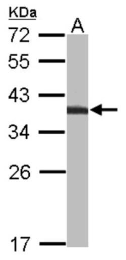 TST Antibody, Novus Biologicals 0.1mL; Unlabeled:Antibodies, Polyclonal
