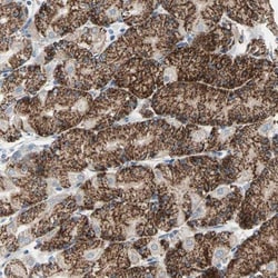 TST Antibody, Novus Biologicals:Antibodies:Primary Antibodies