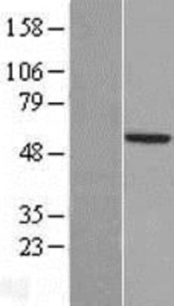 Novus Biologicals&trade;&nbsp;TSTD2 Overexpression Lysate