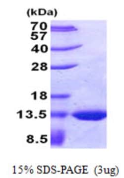 Novus Biologicals&trade;&nbsp;Recombinant E. coli TSTD2 His Protein
