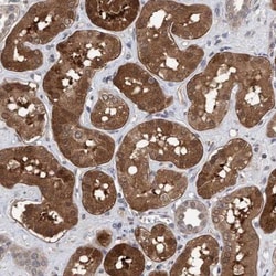 TSTD2 Antibody, Novus Biologicals 0.1mL; Unlabeled:Antibodies, Polyclonal