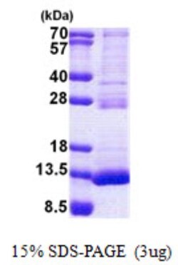 Novus Biologicals&trade;&nbsp;Recombinant Human TSTD3 His Protein