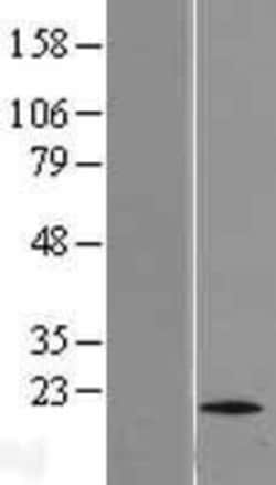 Novus Biologicals&trade;&nbsp;TTC11 Overexpression Lysate