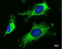 TTC11 Antibody (4211), Novus Biologicals 0.1mL; Unlabeled:Antibodies, Monoclonal