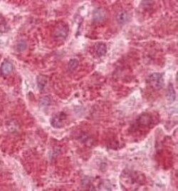 TTC11 Antibody, Novus Biologicals 0.2mL; Unlabeled:Antibodies, Polyclonal