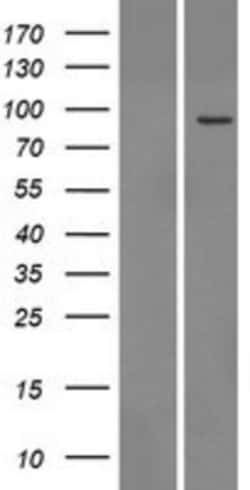 Novus Biologicals&trade;&nbsp;TTC13 Overexpression Lysate