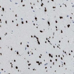 TTC13 Antibody, Novus Biologicals:Antibodies:Primary Antibodies