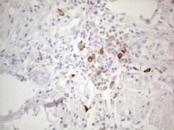 TTC14 Antibody (OTI9E11), Novus Biologicals 0.1mL; Unlabeled:Antibodies,