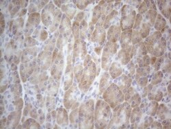 TTC14 Antibody (OTI9E11), Novus Biologicals 0.1mL; Unlabeled:Antibodies,