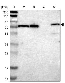 TTC14 Antibody, Novus Biologicals 0.1mL; Unlabeled:Antibodies, Polyclonal