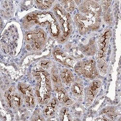 TTC17 Antibody, Novus Biologicals:Antibodies:Primary Antibodies
