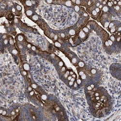 TTC19 Antibody, Novus Biologicals:Antibodies:Primary Antibodies