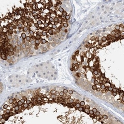 TTC21A Antibody, Novus Biologicals 0.1mL; Unlabeled:Antibodies, Polyclonal