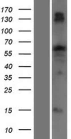 Novus Biologicals&trade;&nbsp;TTC22 Overexpression Lysate
