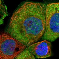 TTC22 Antibody, Novus Biologicals 0.1mL; Unlabeled:Antibodies, Polyclonal