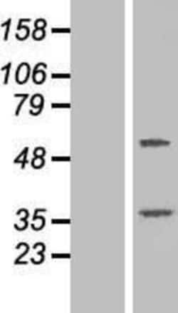 Novus Biologicals&trade;&nbsp;TTC23 Overexpression Lysate