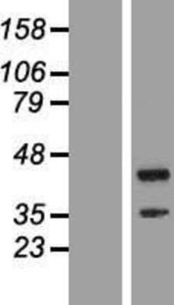 Novus Biologicals™ TTC23L Overexpression Lysate