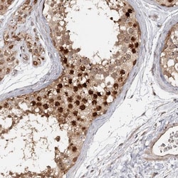 TTC23L Antibody, Novus Biologicals 0.1mL; Unlabeled:Antibodies, Polyclonal