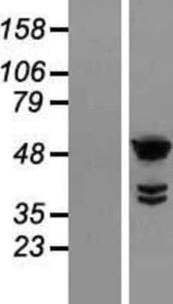 Novus Biologicals&trade;&nbsp;TTC25 Overexpression Lysate
