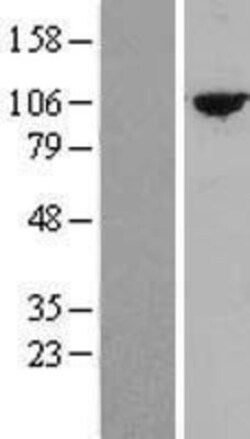Novus Biologicals™ TTC27 Overexpression Lysate