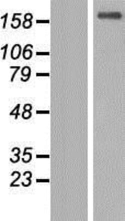 Novus Biologicals&trade;&nbsp;TTC3 Overexpression Lysate