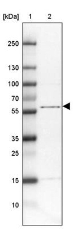 TTC31 Antibody, Novus Biologicals 25 &mu;L | Buy Online | Novus Biologicals | Fisher Scientific
