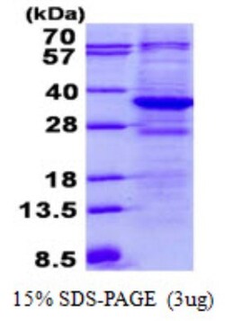 Novus Biologicals&trade;&nbsp;Recombinant Human TTC33 His Protein