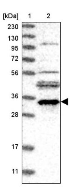 EMC2 Antibody, Novus Biologicals 0.1mL; Unlabeled:Antibodies, Polyclonal