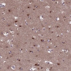 EMC2 Antibody, Novus Biologicals 0.1mL; Unlabeled:Antibodies, Polyclonal