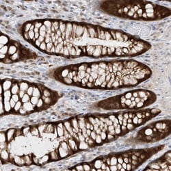 TTC38 Antibody, Novus Biologicals:Antibodies:Primary Antibodies