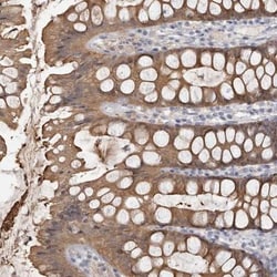 TTC39A Antibody, Novus Biologicals:Antibodies:Primary Antibodies