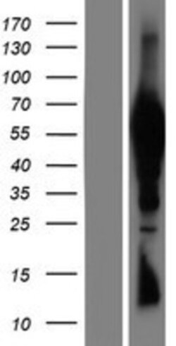 Novus Biologicals™ TTC39B Overexpression Lysate