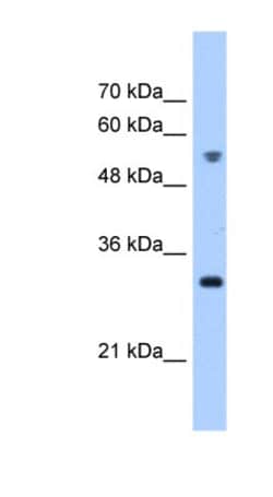 TTC5 Antibody, Novus Biologicals 100&mu;L; Unlabeled:Antibodies, Polyclonal