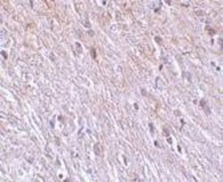 TTC5 Antibody - BSA Free, Novus Biologicals 0.025 mg, Unconjugated:Antibodies,