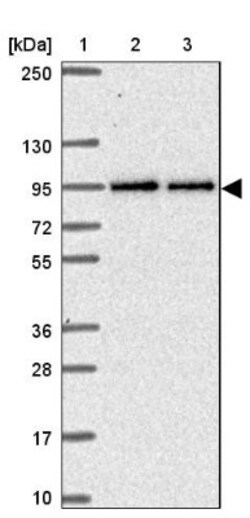 TTC7B Antibody, Novus Biologicals 0.1mL; Unlabeled:Antibodies, Polyclonal