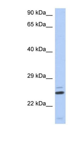 TTC9C Antibody, Novus Biologicals:Antibodies:Primary Antibodies