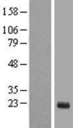 Novus Biologicals™ TTDN1 Overexpression Lysate