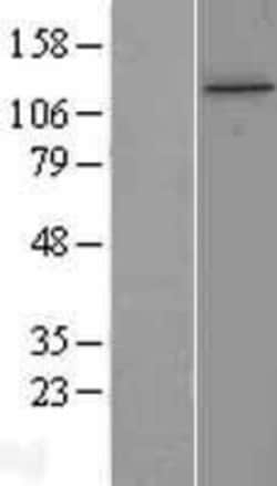 Novus Biologicals&trade;&nbsp;TTI1 Overexpression Lysate