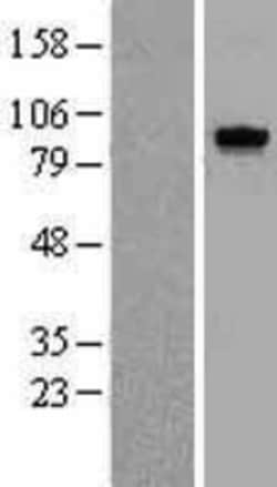 Novus Biologicals&trade;&nbsp;TTK Overexpression Lysate