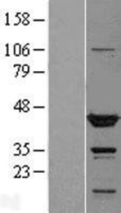 Novus Biologicals&trade;&nbsp;TTL Overexpression Lysate