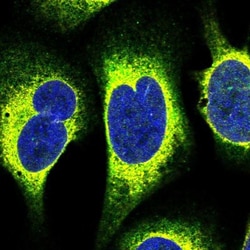 TTLL10 Antibody, Novus Biologicals 0.1mL; Unlabeled:Antibodies, Polyclonal
