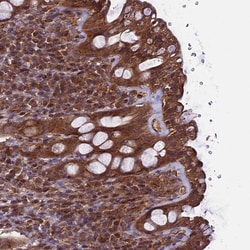 TTLL10 Antibody, Novus Biologicals 0.1mL; Unlabeled:Antibodies, Polyclonal