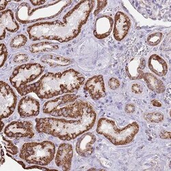 TTLL1 Antibody, Novus Biologicals 0.1mL; Unlabeled:Antibodies, Polyclonal