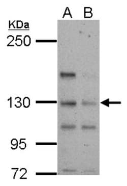 TTLL4 Antibody, Novus Biologicals 0.1mL; Unlabeled:Antibodies, Polyclonal