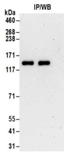 TTLL5 Antibody, Novus Biologicals 0.1mg; Unlabeled:Antibodies, Polyclonal