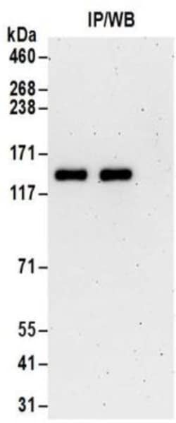 TTLL5 Antibody, Novus Biologicals 0.1mg; Unlabeled:Antibodies, Polyclonal