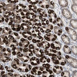 TTMP Antibody, Novus Biologicals 0.1mL; Unlabeled:Antibodies, Polyclonal